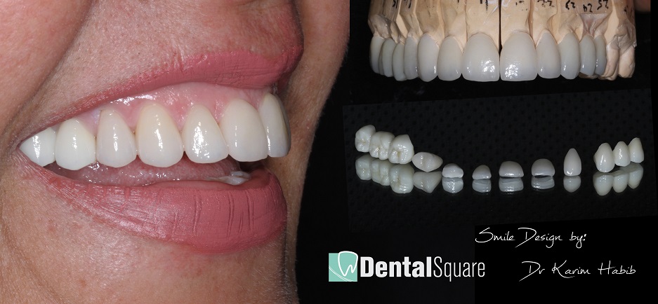 Best quality Cosmetic Dentistry Sydney