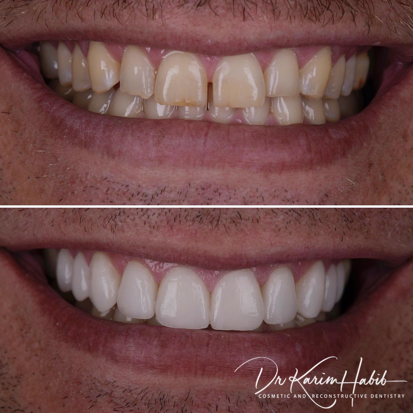 Cosmetic Dentistry Sydney