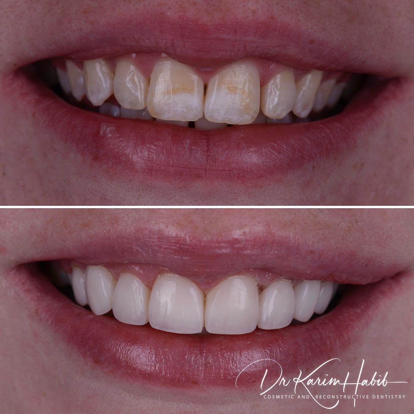 Smile Transformation Australia