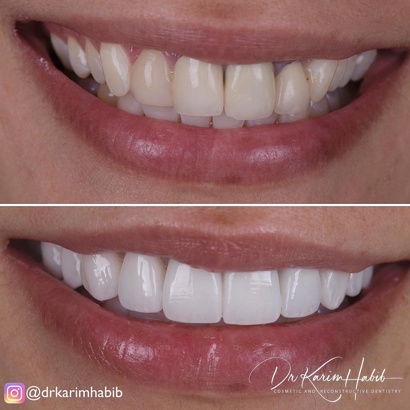 Revision Cosmetic Dentistry