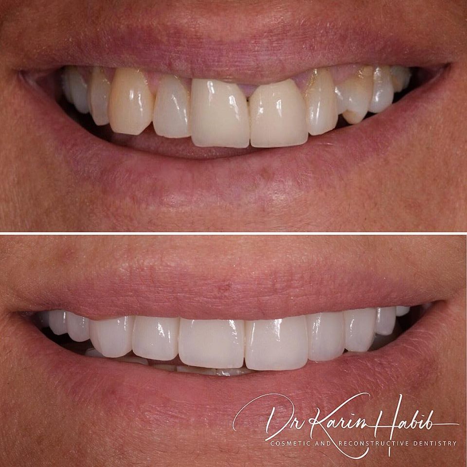 Cosmetic Dentistry Sydney