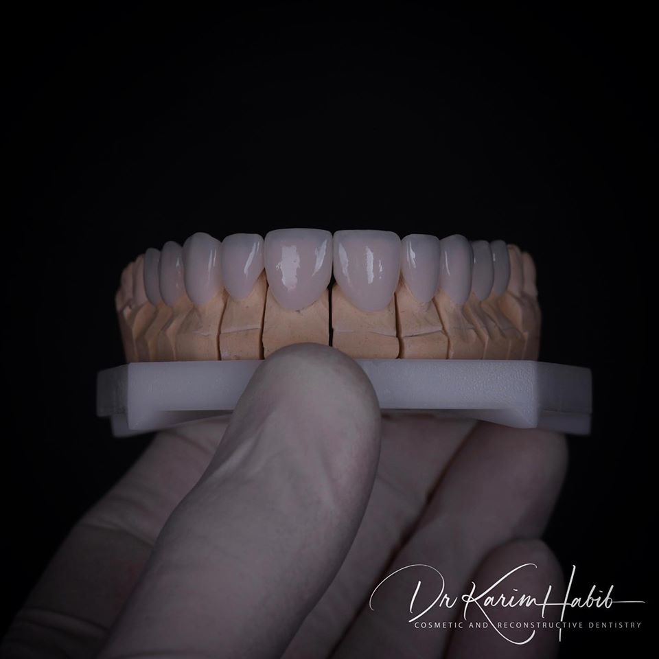 Porcelain Veneers Australia