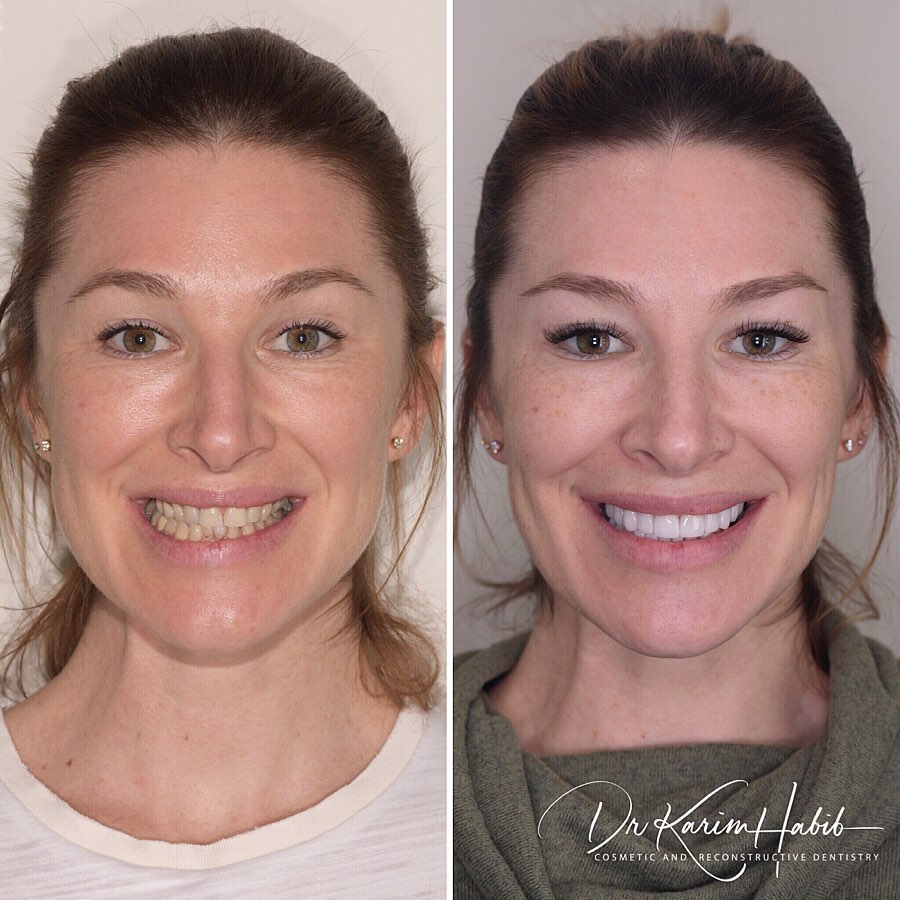 Smilemakeover Expert Sydney Cosmetic Dentist