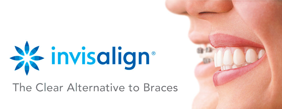 Invisalign treatment sydney