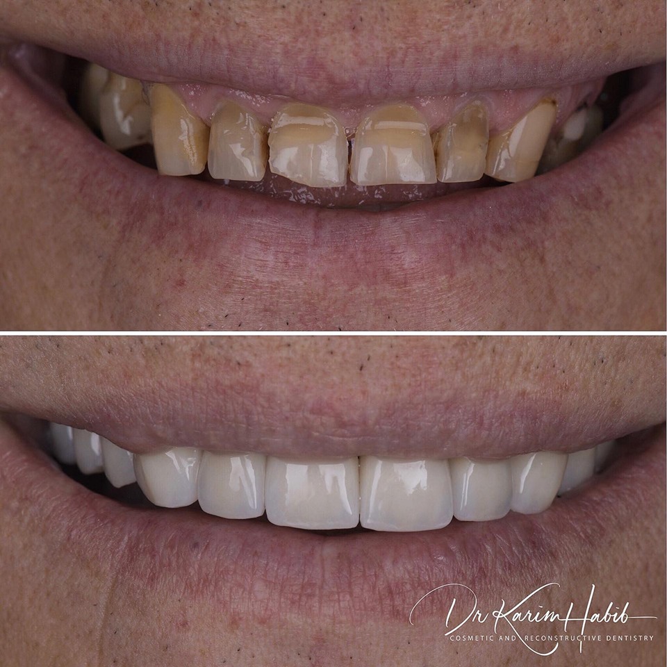 smile makeover sydney